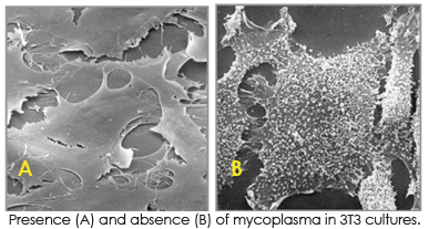 Mycoplasma_SEM