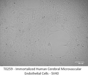 T0259%20Immortalized%20Human%20Cerebral%20Microvascular%20Endothelial%20Cells%20-%20SV40