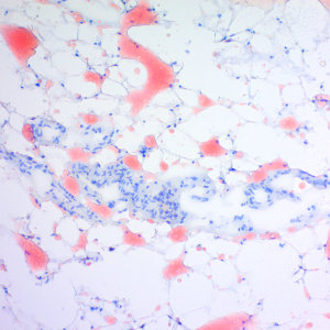 ORK-1-2 Oil Red O Stain kit